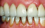 Cosmetic Dentistry Smile Makeovers - after